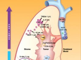 dau hieu ung thu phoi
