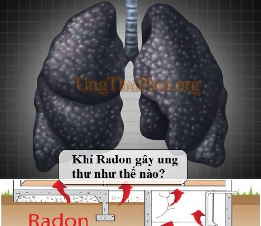 khi radon gay ung thu phoi (1)