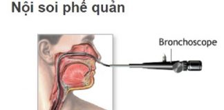 noi soi phe quan la mot xet nghiem de xem duong tho va chan doan benh phoi (1)