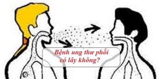 benh ung thu phoi co lay khong