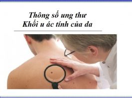thong so ung thu - khoi u ac tinh cua da