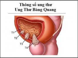 thong so ung thu - ung thu bang quang