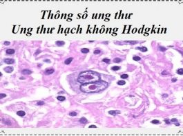 thong so ung thu - ung thu hach khong hodgkin