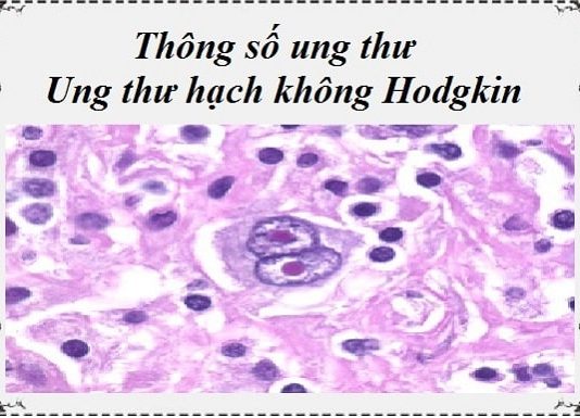 thong so ung thu - ung thu hach khong hodgkin