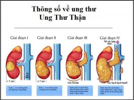 thong so ung thu - ung thu than