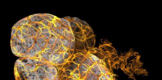 Phát hiện tế bào miễn dịch trong điều trị ung thư vú - 1