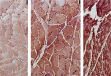 Tìm ra cách chặn đứng tác nhân dẫn đến 1/3 số ca tử vong do ung thư - 1