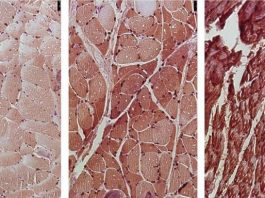 Tìm ra cách chặn đứng tác nhân dẫn đến 1/3 số ca tử vong do ung thư - 1