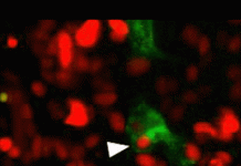 Xem tế bào ung thư “ăn thịt” đồng loại để sinh tồn - 1