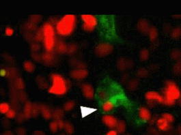 Xem tế bào ung thư “ăn thịt” đồng loại để sinh tồn - 1
