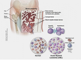Hút thuốc làm giảm thời gian sống sau điều trị của bệnh nhân ung thư - 1