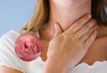 3 chị em bị ung thư vòm họng, bác sĩ cảnh báo thực phẩm nhiều người thích - 1