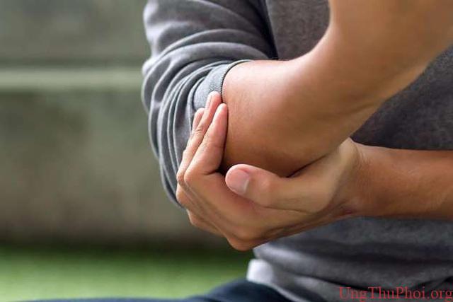 9 dấu hiệu ung thư máu dễ bị bỏ qua - 3 9 dấu hiệu ung thư máu dễ bị bỏ qua - 3