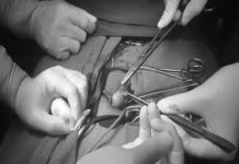 Bỗng nhiên bị sùi đầu dương vật, coi chừng ung thư - 1