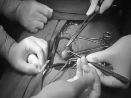 Bỗng nhiên bị sùi đầu dương vật, coi chừng ung thư - 1