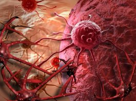 Lần đầu phát hiện gen di truyền “điều khiển” quá trình di căn của ung thư - 1