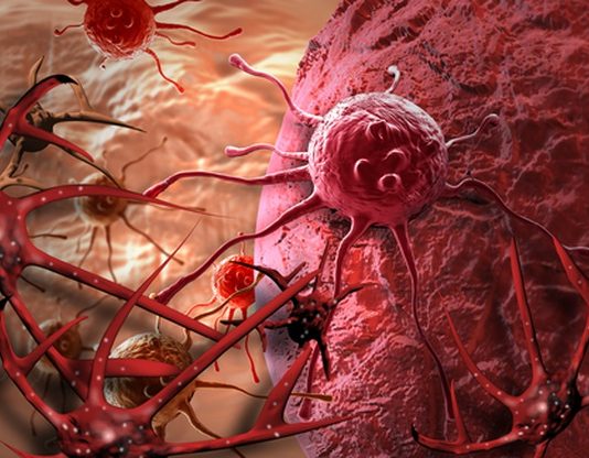 Lần đầu phát hiện gen di truyền “điều khiển” quá trình di căn của ung thư - 1