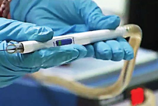 Phát triển thành công “dao thông minh” giúp phát hiện nhanh ung thư - 1