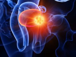 Trẻ em gặp những vấn đề này dễ đối mặt với ung thư khi lớn lên - 1