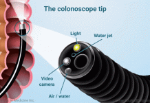 Bác sĩ diệt mầm mống ung thư đại tràng bằng kỹ thuật nội soi như thế nào? - 1