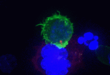 Cận cảnh “sát thủ” của hệ miễn dịch tiêu diệt tế bào ung thư - 1