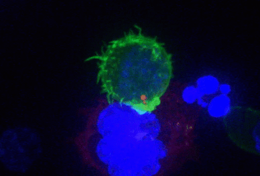 Cận cảnh “sát thủ” của hệ miễn dịch tiêu diệt tế bào ung thư - 1