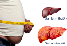 Hai căn bệnh không chữa sớm rất dễ chuyển thành ung thư - 1