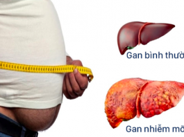 Hai căn bệnh không chữa sớm rất dễ chuyển thành ung thư - 1