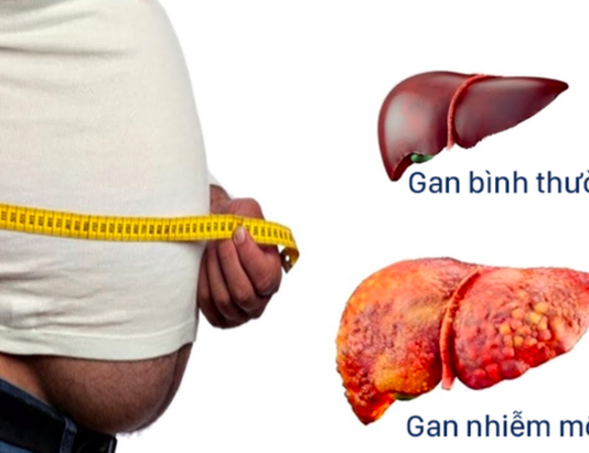 Hai căn bệnh không chữa sớm rất dễ chuyển thành ung thư - 1