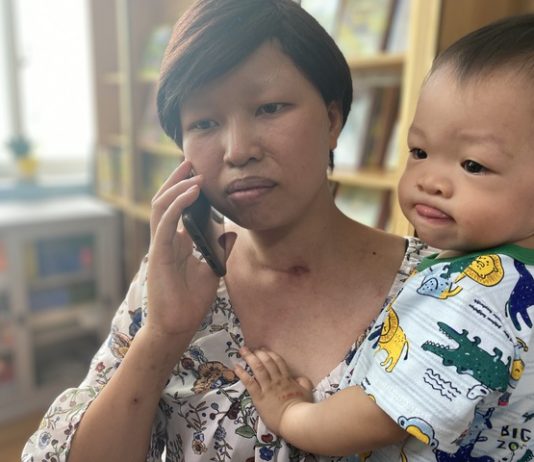 Một năm bên con của người mẹ ung thư giai đoạn cuối sau ca mổ ngồi lấy thai - 1