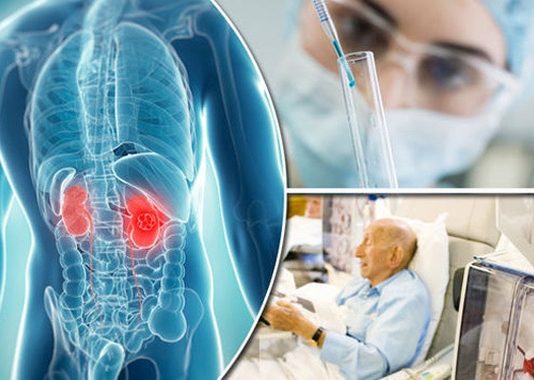 Người đàn ông phát hiện bị ung thư sau tai nạn xe hơi - 1