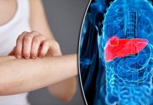 Sút cân, mệt mỏi có phải đã mắc ung thư gan? - 1