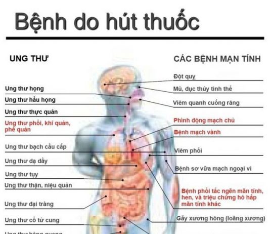 Hút thuốc lá, nguy cơ mắc ung thư phổi cao gấp hàng chục lần - 1
