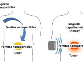Những phương pháp tiên tiến có thể giúp con người chiến thắng ung thư - 1