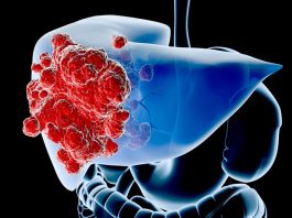 Cả đời không lo ung thư gan khi dành 1 phút làm điều này mỗi ngày - 1