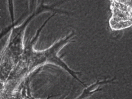 Xem ung thư biến tế bào khỏe mạnh trở thành tay sai đắc lực - 1