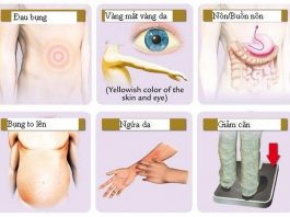 Có những dấu hiệu này cần đi khám ung thư gan ngay - 1