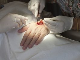 Đã có miếng dán truyền thuốc điều trị ung thư da không gây đau đớn? - 1