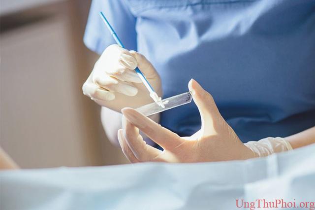 Những phương pháp tầm soát ung thư giúp bạn chủ động trước bệnh tật - 4 Những phương pháp tầm soát ung thư giúp bạn chủ động trước bệnh tật - 4