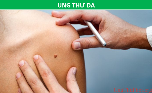 Những phương pháp tầm soát ung thư giúp bạn chủ động trước bệnh tật - 9 Những phương pháp tầm soát ung thư giúp bạn chủ động trước bệnh tật - 9