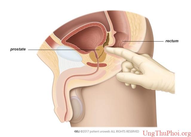Những phương pháp tầm soát ung thư giúp bạn chủ động trước bệnh tật - 11 Những phương pháp tầm soát ung thư giúp bạn chủ động trước bệnh tật - 11