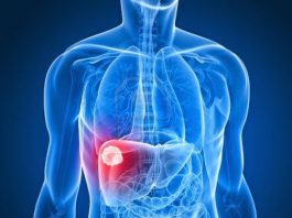 3 dấu hiệu lạ vào buổi sáng tố cáo ung thư gan giai đoạn đầu - 1