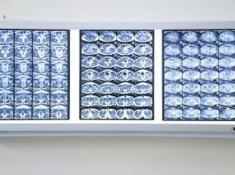 Hai bệnh nhân 90 tuổi được phẫu thuật thành công ung thư đường tiêu hoá - 1