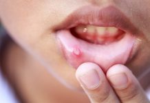 Có những dấu hiệu này bạn nên đi khám ung thư ngay - 1