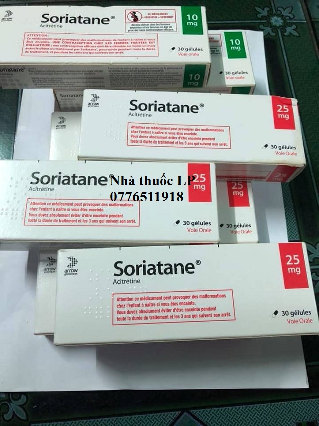 Thuốc Soriatane 25mg Acitretin điều trị bệnh vẫy nến (2)