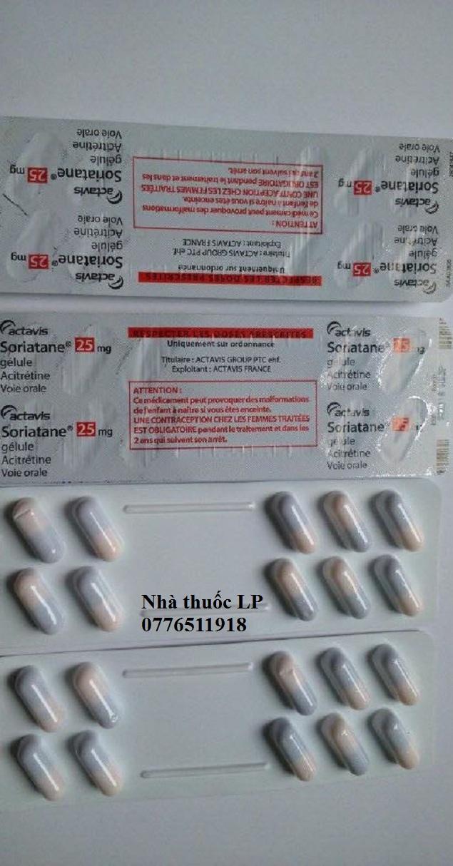 Thuốc Soriatane 25mg Acitretin điều trị bệnh vẫy nến (3)